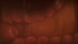 what is anime and why do people watch it